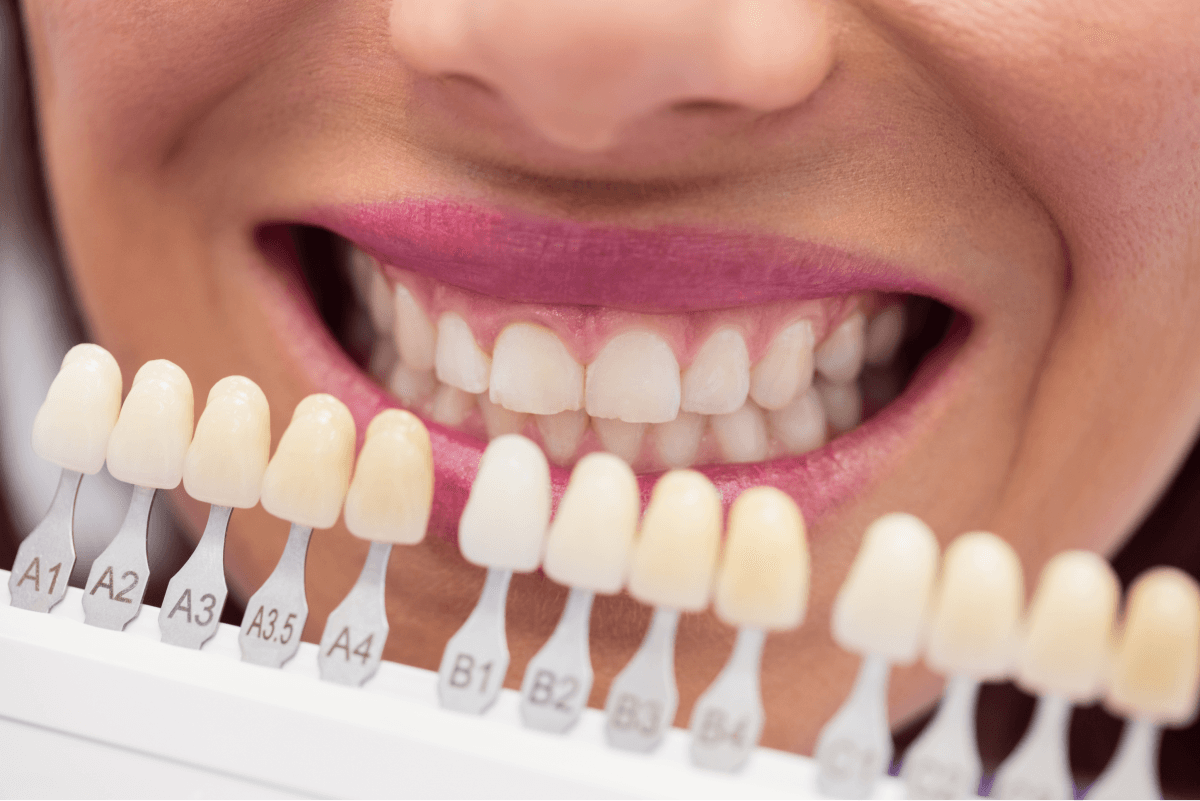 4 Ways to Improve Your Smile